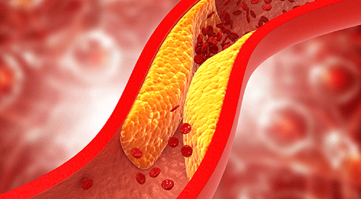 নীরব ঘাতক কোলেস্টেরল!