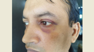 স্কুলশিক্ষক অপহরণ, পাশবিক নির্যাতন ও সর্বস্ব লুটের অভিযোগে মামলা