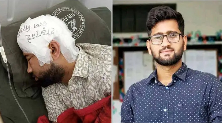 চবি শিক্ষার্থী মামুনের খুলির সফল প্রতিস্থাপন