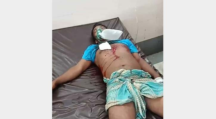 রাউজানে সন্ত্রাসীদের গুলিতে পাঁচজন আহত