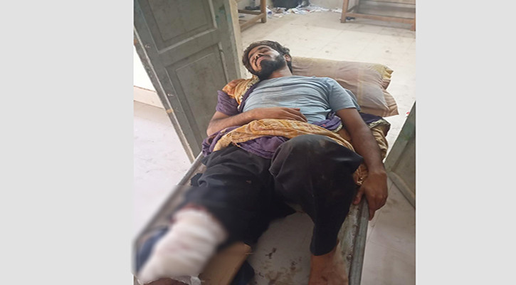 গাছ চোরাকারবারিদের হামলায় ২ বনকর্মী আহত