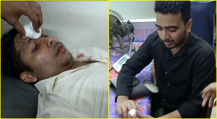 জবির দুই বিভাগের শিক্ষার্থীদের মধ্যে হাতাহাতি, শিক্ষকসহ আহত ১২