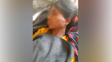 স্ত্রীর মুখে গরম রডের ছ্যাঁকা, কেটে দিলেন পায়ের রগ!