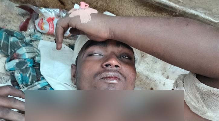 যশোরে গরু চুরি করে ট্রাকে ওঠানোর সময় গণপিটুনি