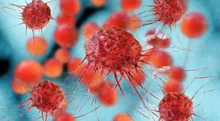 প্রয়োজনের তুলনায় অপ্রতুল ক্যানসার চিকিৎসা