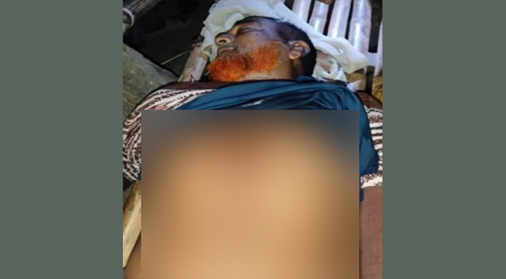 কুষ্টিয়ায় দুর্বৃত্তদের গুলিতে একজন নিহত, ২ জন হাসপাতালে