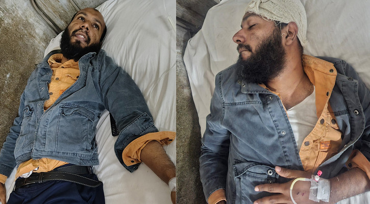 সাংবাদিককে হাতুড়িপেটার ঘটনায় পুলিশ সদস্য ক্লোজড