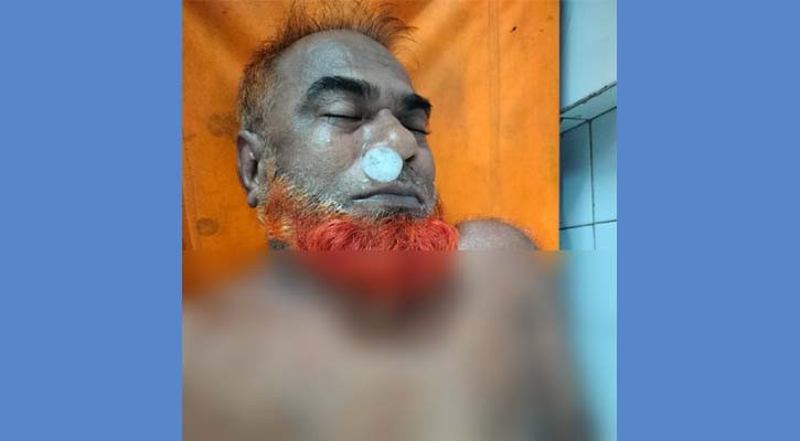 যশোর কারাগারে কয়দিনের মৃত্যু