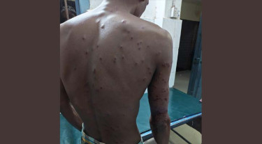 চুয়াডাঙ্গা সীমান্তে বিএসএফের গুলিতে বাংলাদেশি আহত