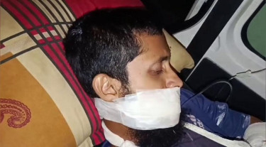 গোপালগঞ্জে ককটেল বানাতে গিয়ে যুবক আহত