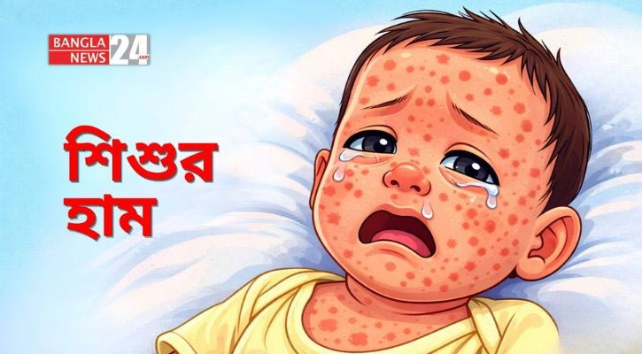রাজশাহীতে দুর্ঘটনায় একজন নিহতের জেরে দুই ট্রাকে আগুন