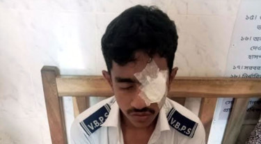উত্তরপত্র দেখতে না দেওয়ায় সহপাঠীর ঘুষিতে পরীক্ষার্থী হাসপাতালে