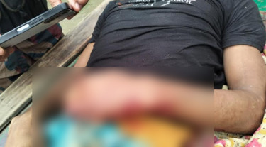 হাতীবান্ধা সীমান্তে বাংলাদেশিকে গুলি করে মারল বিএসএফ