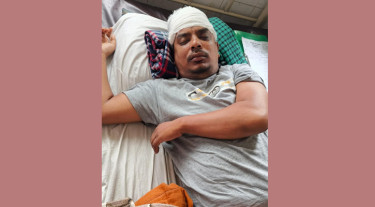 আড়াইহাজারে ডাকাতি, দুই ভাই আহত