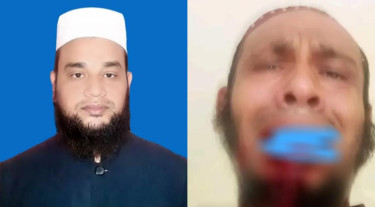 ঘুষি মেরে কম্পিউটার অপারেটরের দাঁত ভেঙে দিলেন অধ্যক্ষ