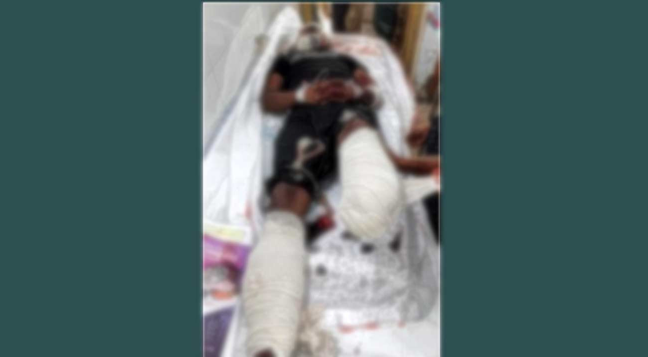 গাইবান্ধায় চলন্ত ট্রেন থেকে পড়ে যাত্রীর দুই পা বিচ্ছিন্ন