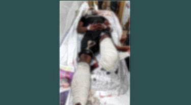 গাইবান্ধায় চলন্ত ট্রেন থেকে পড়ে যাত্রীর দুই পা বিচ্ছিন্ন