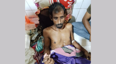যশোরে বজ্রপাতে দুই কৃষক হতাহত