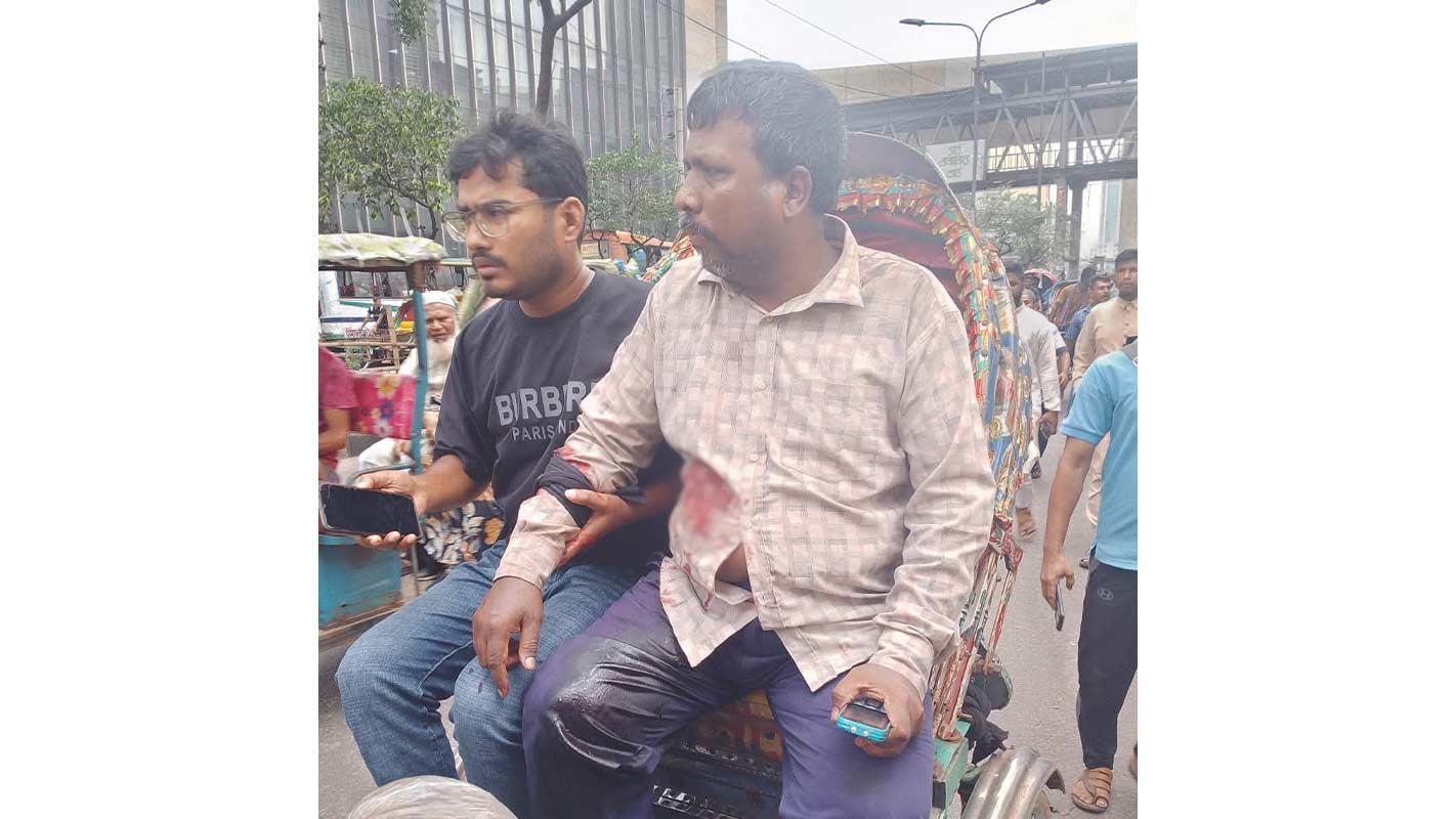 মতিঝিলে ব্যবসায়ীকে গুলি করে ১৭ হাজার ডলার ছিনতাই