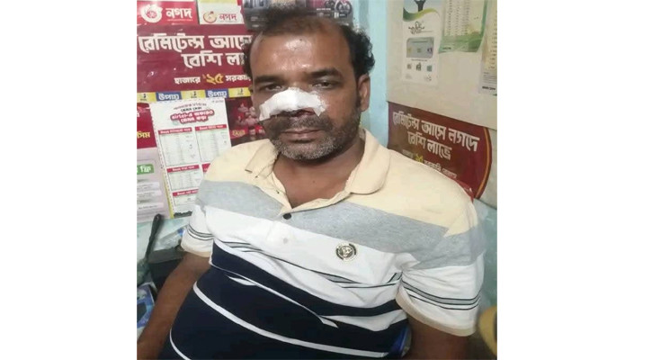 মরিচের গুঁড়া ছুড়ে ব্যবসায়ীর সর্বস্ব ছিনতাই