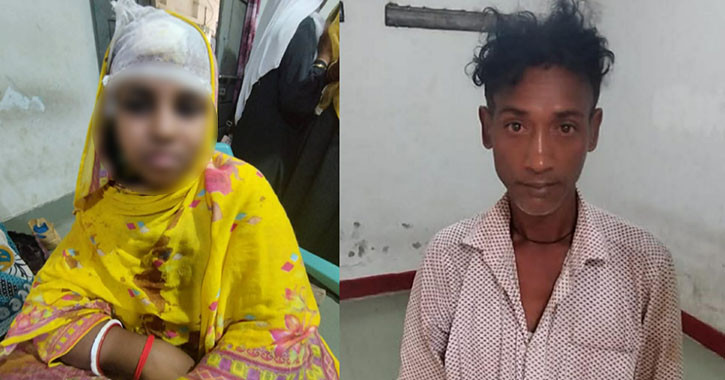 হাতুড়ি দিয়ে স্ত্রীর মাথা ফাটালো স্বামী