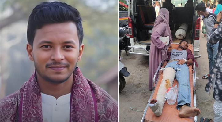 সিএনজিতে ব্যাটারি অটোরিকশার ধাক্কা, এনসিপি নেতা জুবায়ের আহত