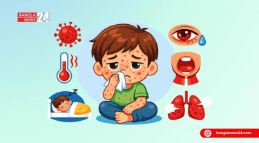 মমেক হাসপাতালে হাম-নিউমোনিয়া আক্রান্ত ৪ শিশুর মৃত্যু