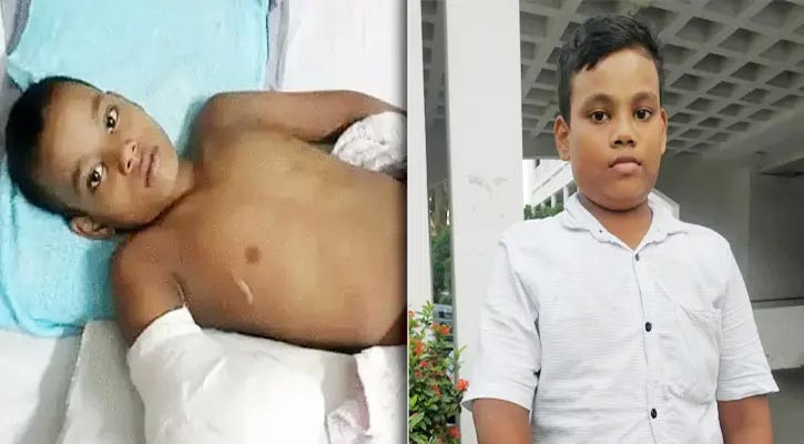 ৩০ লাখ টাকা পেল হাত হারানো নাঈম