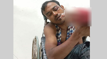 তিনতলার ছাদ থেকে লাফ দিলো চোর