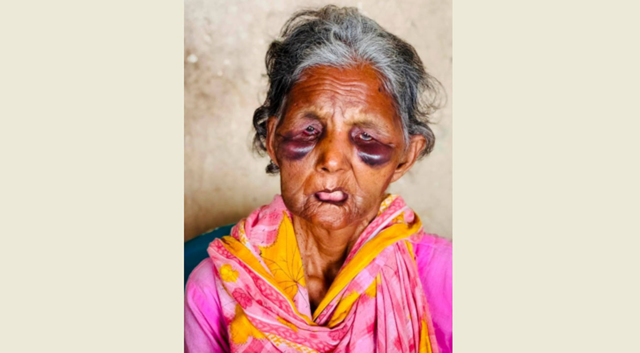 নরসিংদী রেলস্টেশনে হামলার শিকার বাকপ্রতিবন্ধী ববি বেগম মারা গেছেন