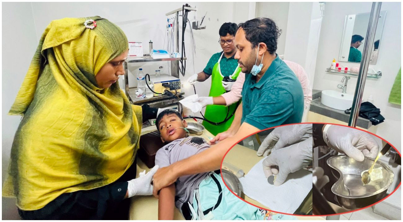 ফরিদপুরে শিশুর পাকস্থলীতে আটকে ছিল ৫ টাকার কয়েন