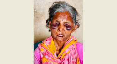 নরসিংদী রেলস্টেশনে হামলার শিকার বাকপ্রতিবন্ধী ববি বেগম মারা গেছেন