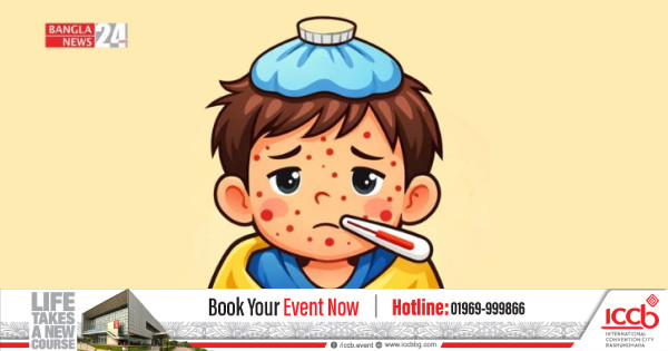 হাম উপসর্গে আরও তিনজনের মৃত্যু