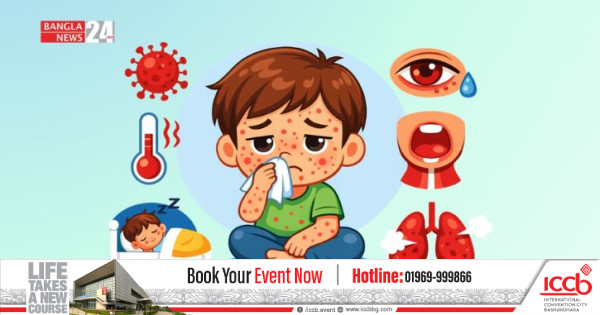 হাম উপসর্গে আরও দুইজনের মৃত্যু