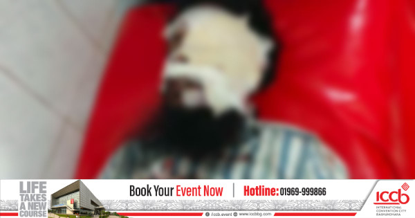মোবাইল ফোনে গেম খেলার সময় বিস্ফোরণ, আহত ২