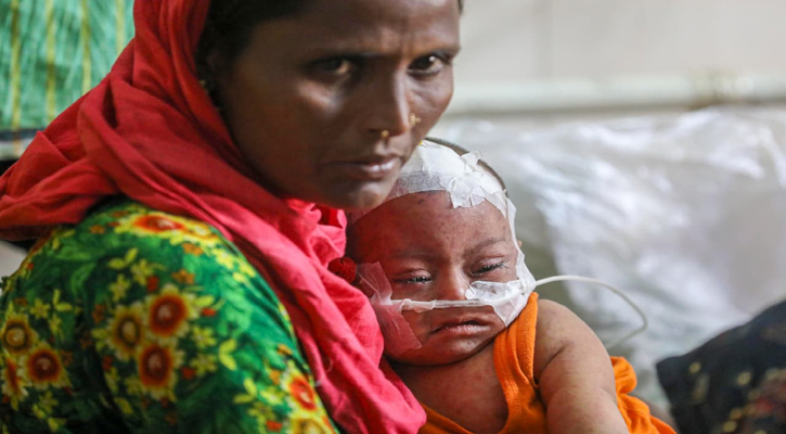 Measles-4