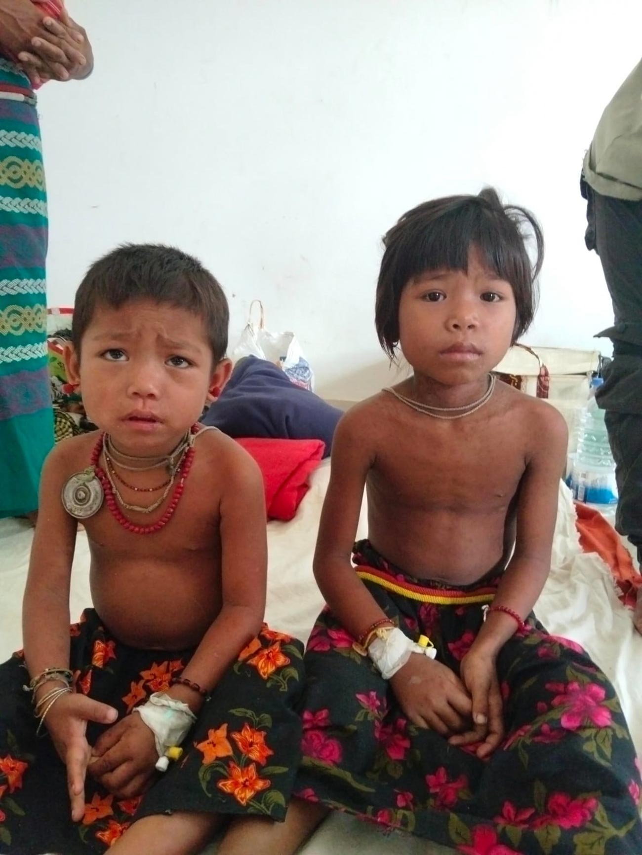 হামের থাবায় পাহাড়েও মরছে শিশু